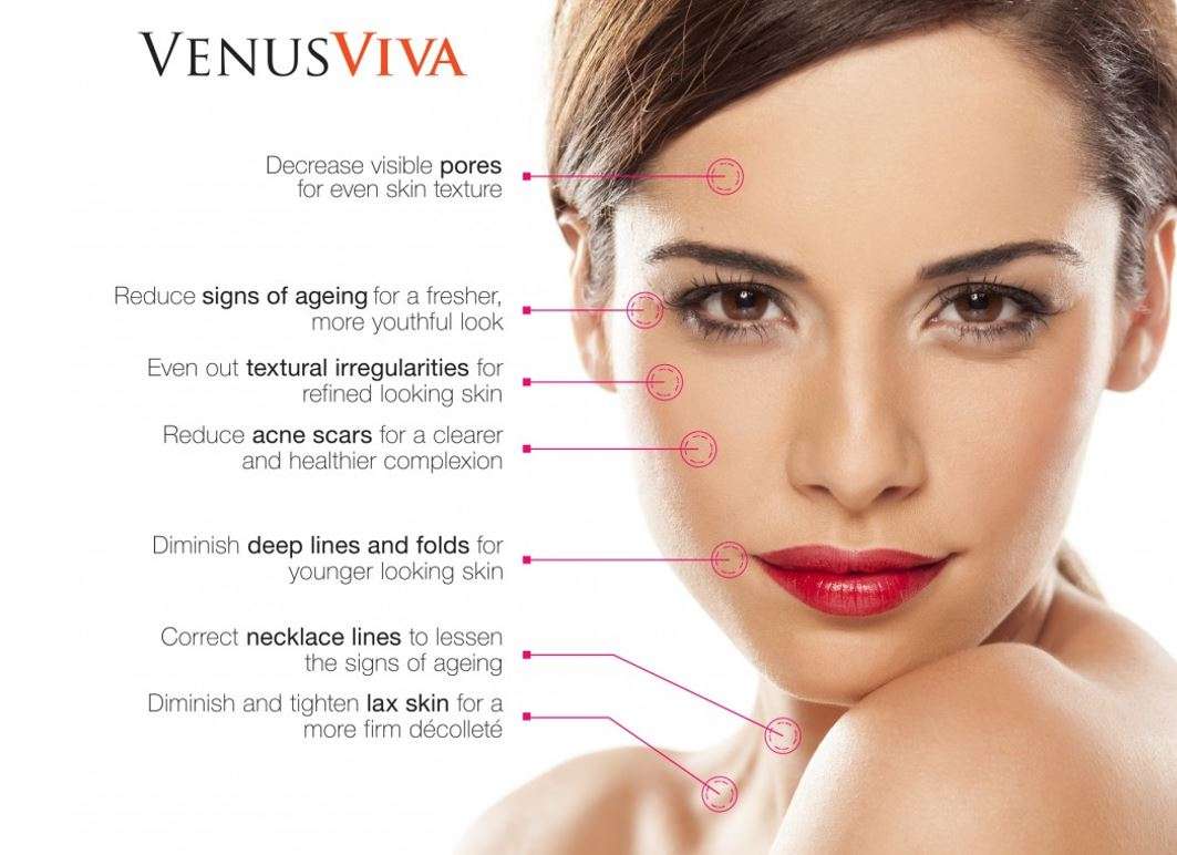 venus viva for youthful skin in chicago kovak cosmetic center - facial sculpting & contouring treatment in chicago