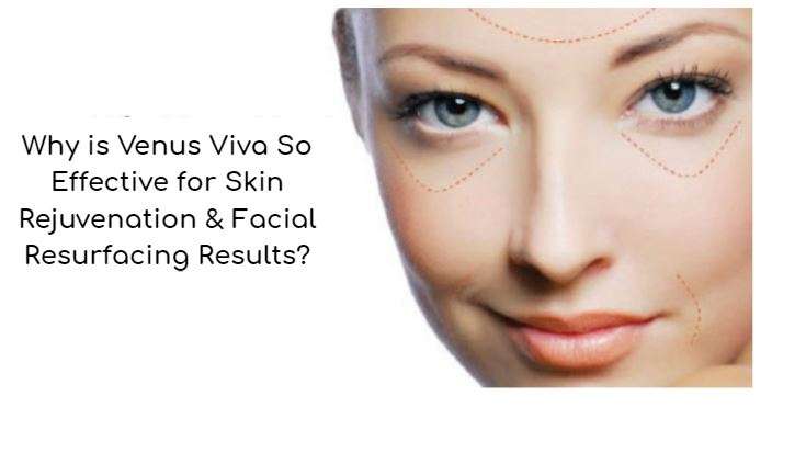 why venus viva treatments are so effective for skin rejuvenation and facial resurfacing results kovak cosmetic center - why venus viva treatments are so effective for skin rejuvenation and facial resurfacing results
