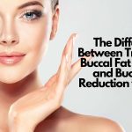 the difference between traditional buccal fat removal and buccal fat reduction with vlr  kovak cosmetic center - the difference between traditional buccal fat removal and buccal fat reduction with vlr