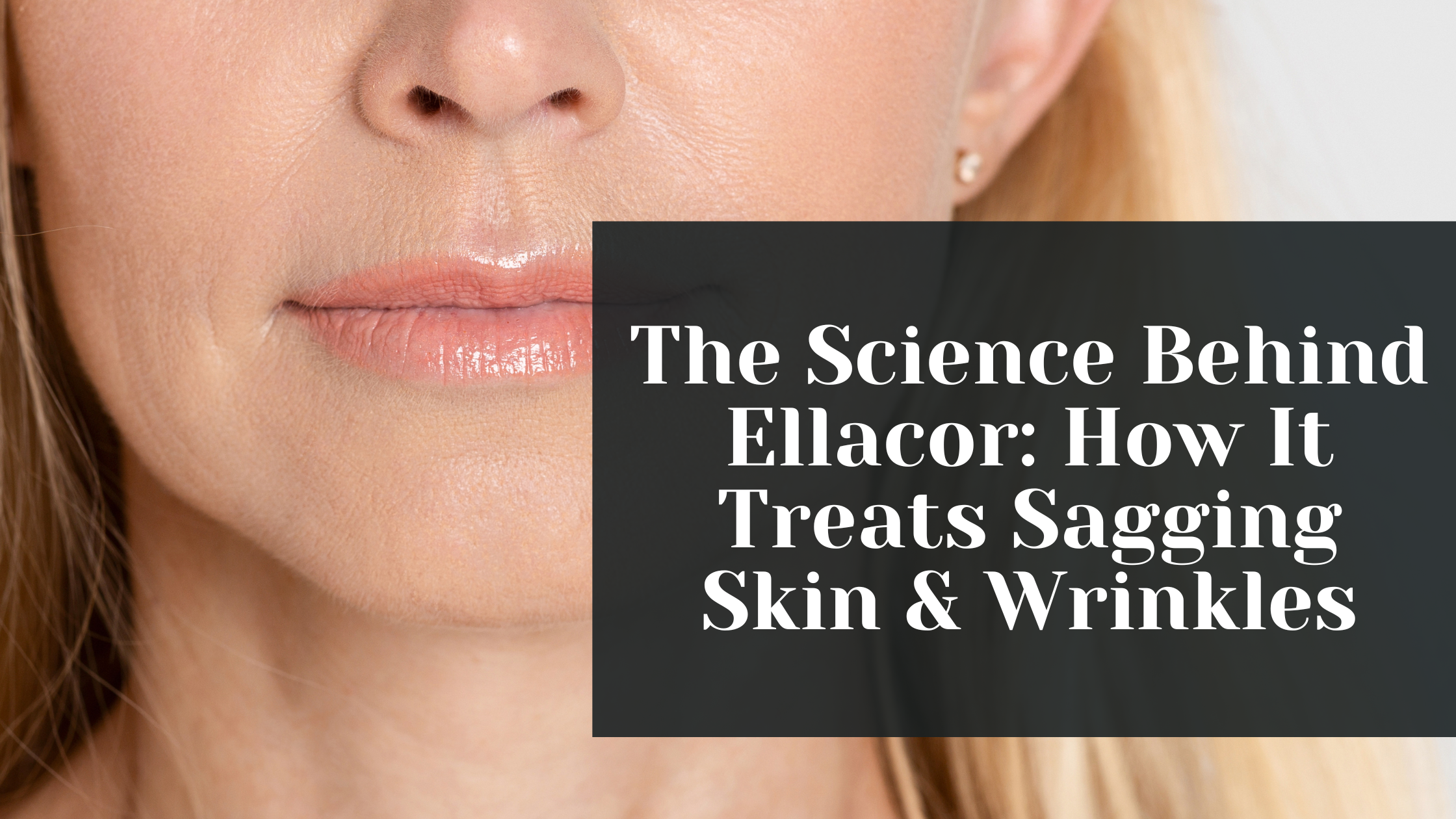 the science behind ellacor and how it treats sagging skin wrinkles  kovak cosmetic center - the science behind ellacor and how it treats sagging skin wrinkles