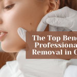 the top benefits of professional mole removal in chicago  kovak cosmetic center - the top benefits of professional mole removal in chicago