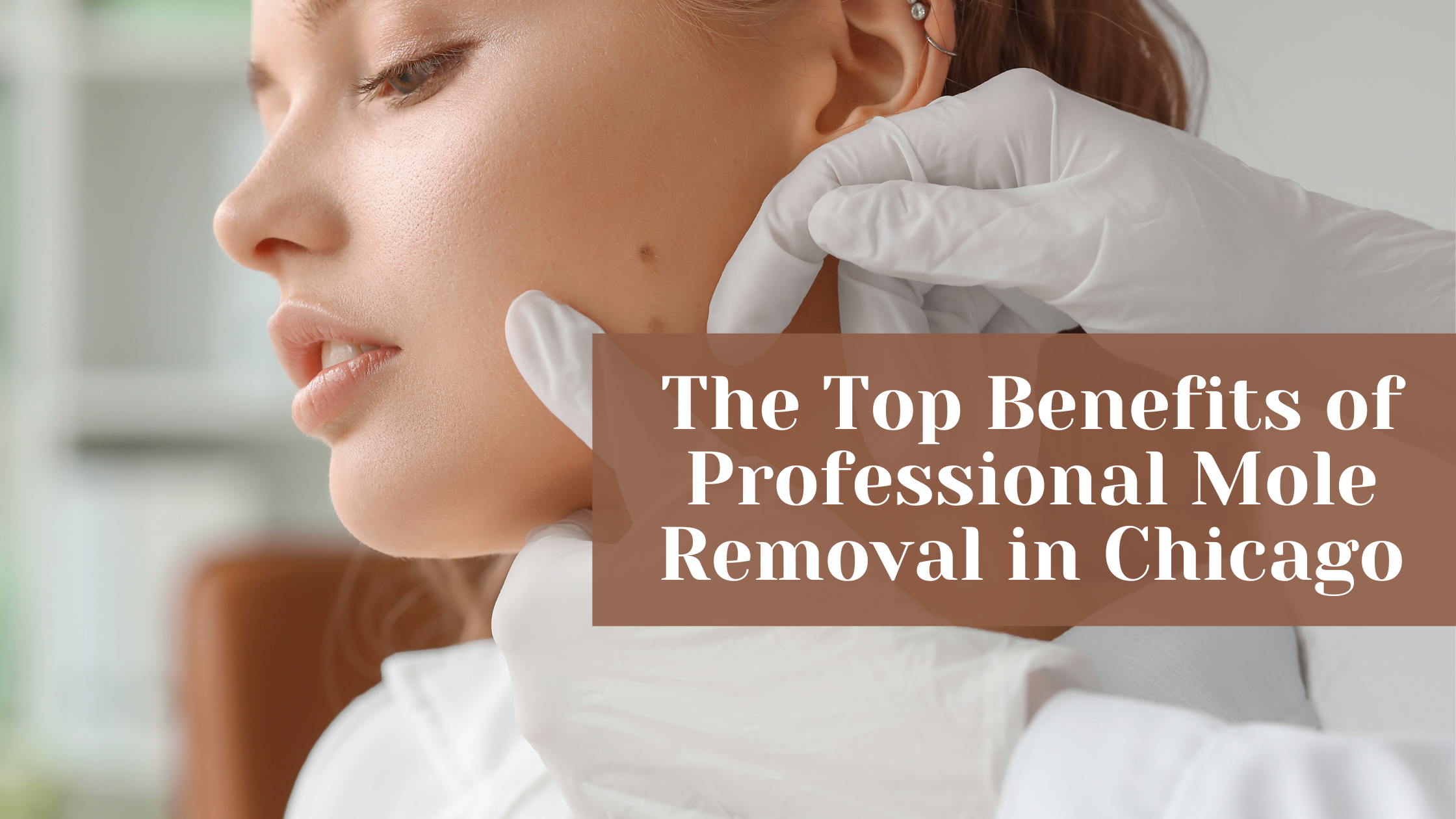 the top benefits of professional mole removal in chicago