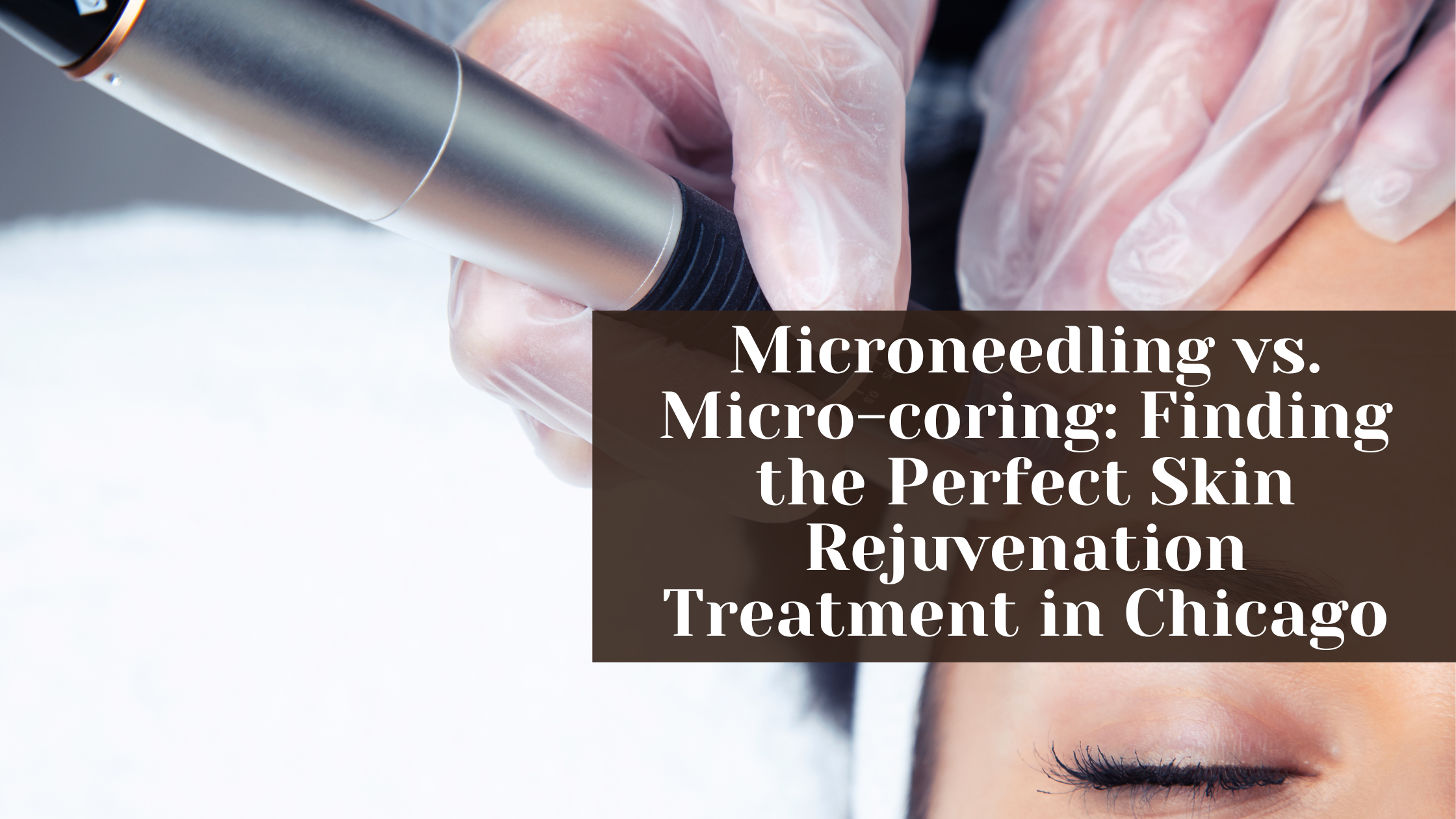 microneedling vs micro coring finding the perfect skin rejuvenation treatment in chicago