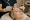 2025 07 kovakcosmeticcenter.com img microneedling facial treatment final