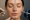 2025 08 kovakcosmeticcentercom img before after facial injections v1