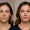 2025 07 kovakcosmeticcenter.com img juvederm before after final