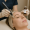2025 07 kovakcosmeticcenter.com img microneedling facial treatment final
