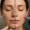 2025 08 kovakcosmeticcentercom img before after facial injections v1