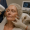 2025 08 kovakcosmeticcentercom img combined facial laser injection v1