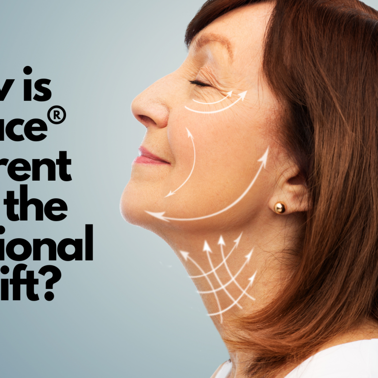 how is emface® different than the traditional facelift