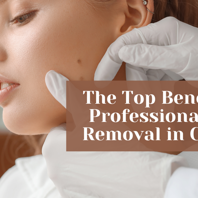 the top benefits of professional mole removal in chicago