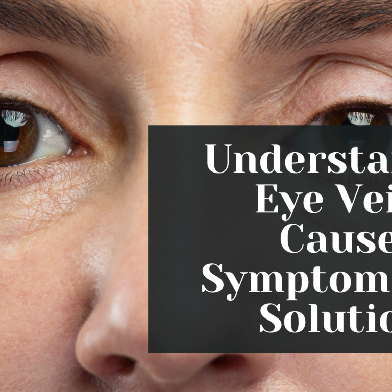 understanding eye veins causes symptoms and solutions